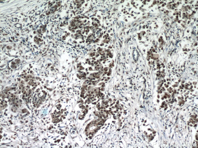 ESR2 Beta-3 Antibody in Immunohistochemistry (Paraffin) (IHC (P))