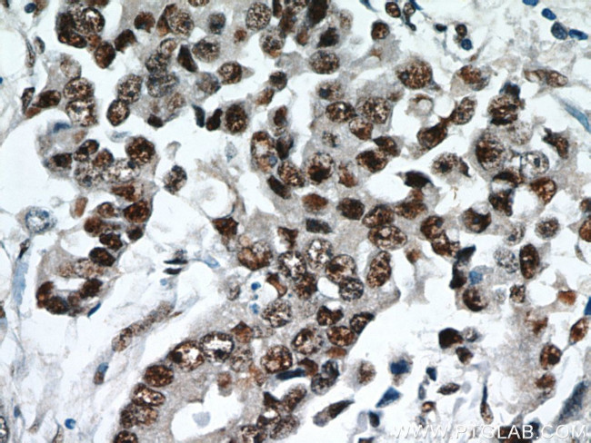 ESR2 Beta-3 Antibody in Immunohistochemistry (Paraffin) (IHC (P))