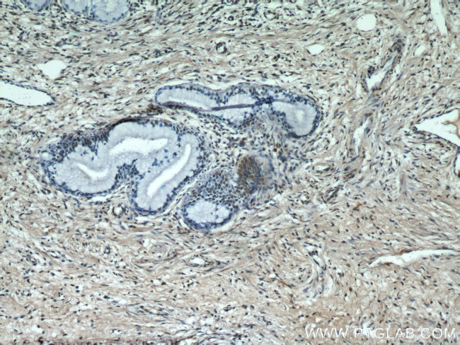 ESR2 Beta-3 Antibody in Immunohistochemistry (Paraffin) (IHC (P))