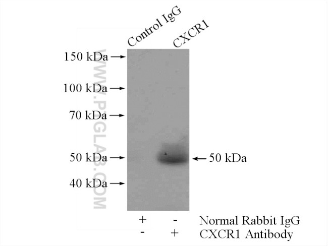 CXCR1 Antibody in Immunoprecipitation (IP)