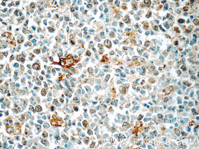 CLEC9A Antibody in Immunohistochemistry (Paraffin) (IHC (P))