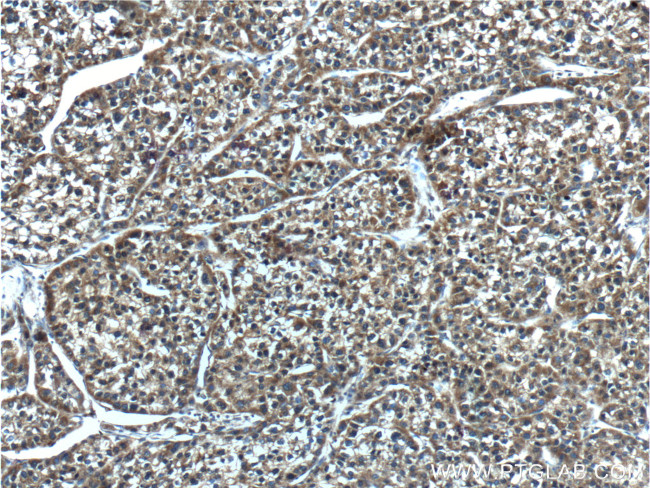 CYP2C19 Antibody in Immunohistochemistry (Paraffin) (IHC (P))