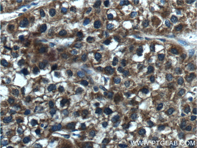 CYP2C19 Antibody in Immunohistochemistry (Paraffin) (IHC (P))