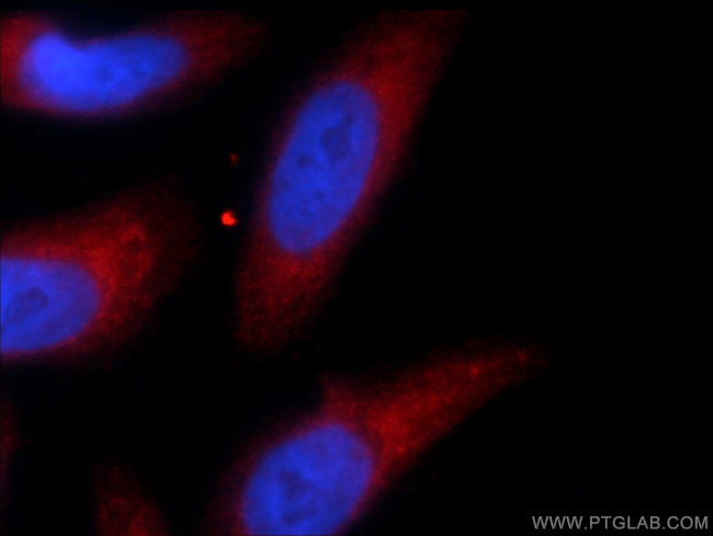 TRIM63 Antibody in Immunocytochemistry (ICC/IF)