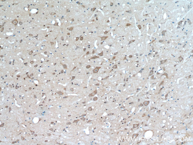 TRIM63 Antibody in Immunohistochemistry (Paraffin) (IHC (P))