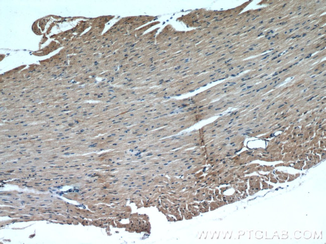 TRIM63 Antibody in Immunohistochemistry (Paraffin) (IHC (P))