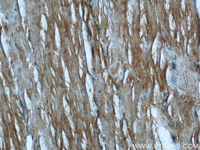 TRIM63 Antibody in Immunohistochemistry (Paraffin) (IHC (P))