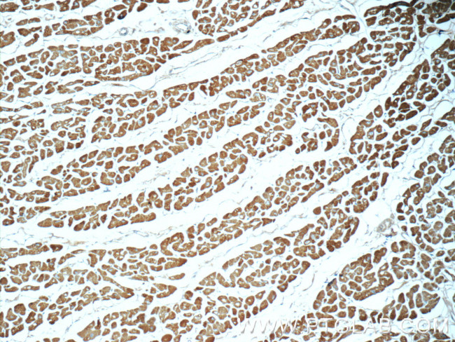 Myosin Light Chain 2 Antibody in Immunohistochemistry (Paraffin) (IHC (P))