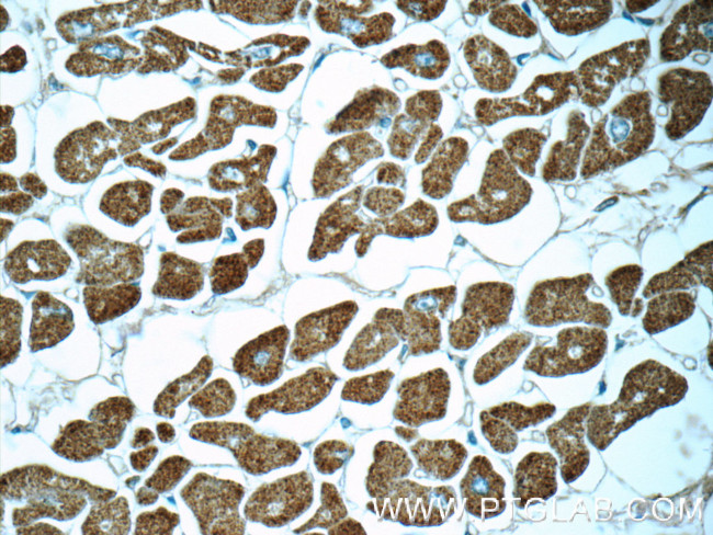 Myosin Light Chain 2 Antibody in Immunohistochemistry (Paraffin) (IHC (P))