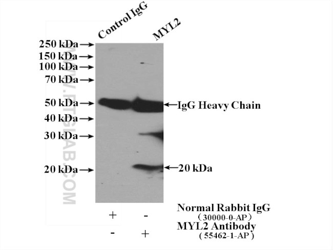 Myosin Light Chain 2 Antibody in Immunoprecipitation (IP)