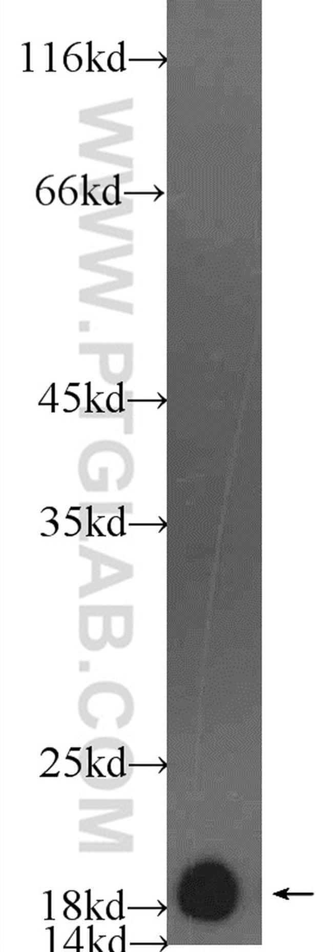 Myosin Light Chain 2 Antibody in Western Blot (WB)