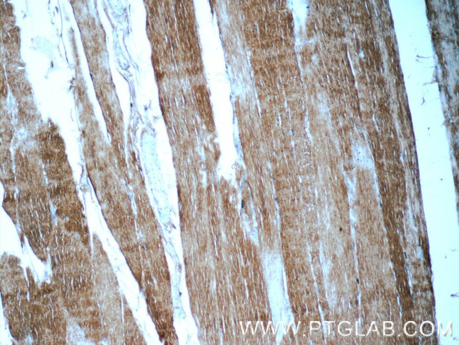 Myosin Light Chain 2 Antibody in Immunohistochemistry (Paraffin) (IHC (P))