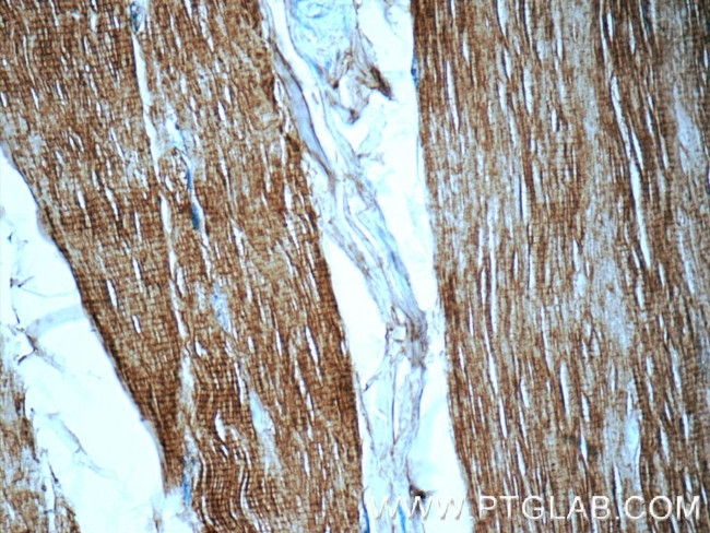 Myosin Light Chain 2 Antibody in Immunohistochemistry (Paraffin) (IHC (P))