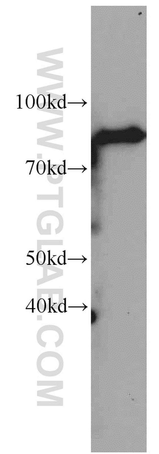 NUP88 Antibody in Western Blot (WB)