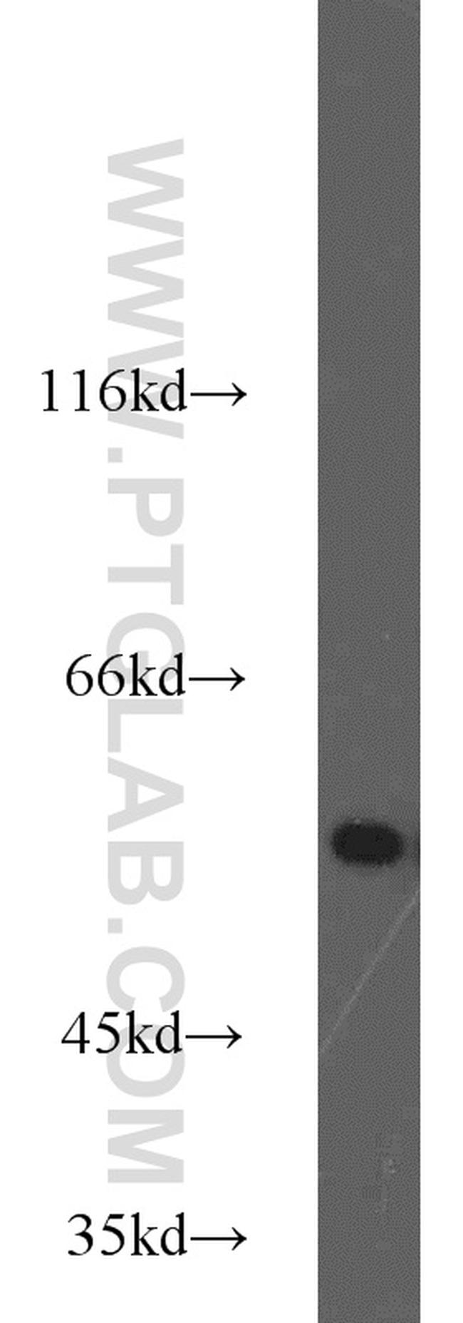 MMP20 Antibody in Western Blot (WB)