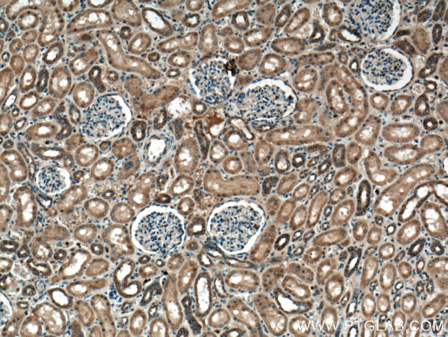 RAB7A Antibody in Immunohistochemistry (Paraffin) (IHC (P))