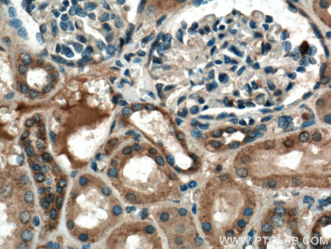 RAB7A Antibody in Immunohistochemistry (Paraffin) (IHC (P))