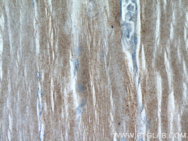 RAB7A Antibody in Immunohistochemistry (Paraffin) (IHC (P))