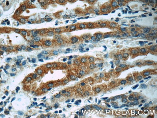 RAB7A Antibody in Immunohistochemistry (Paraffin) (IHC (P))