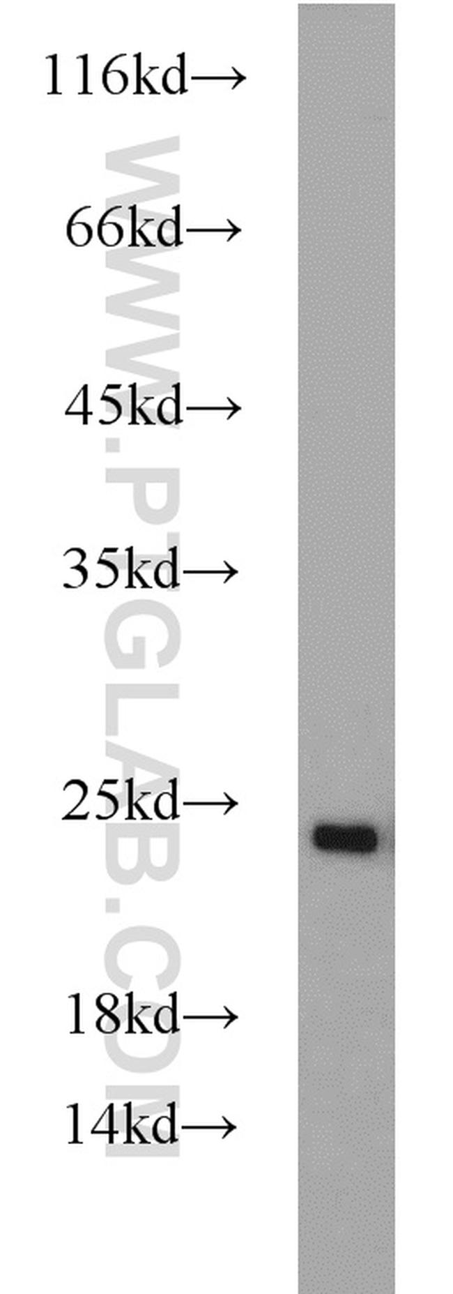 RAB7A Antibody in Western Blot (WB)