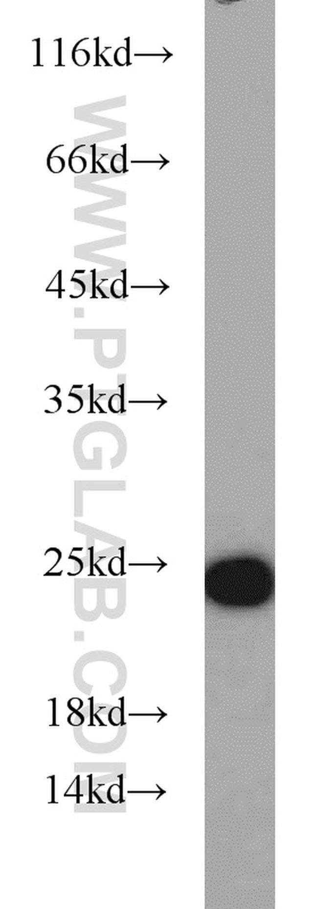 RAB7A Antibody in Western Blot (WB)