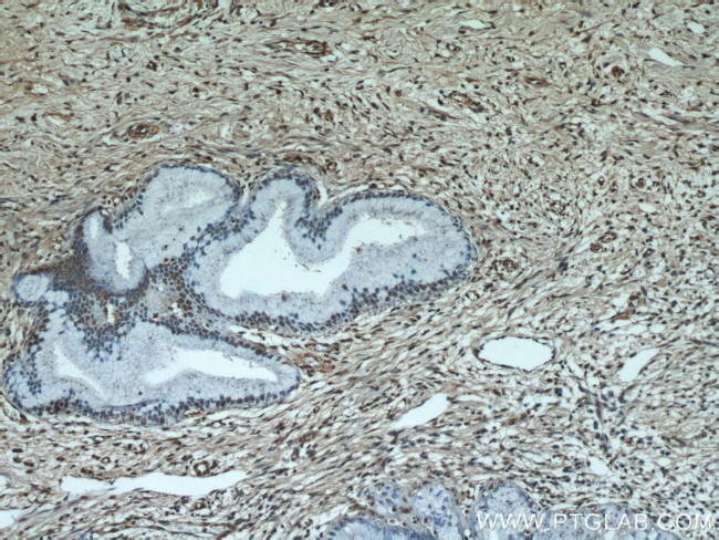 ESR2 Beta-6 Antibody in Immunohistochemistry (Paraffin) (IHC (P))