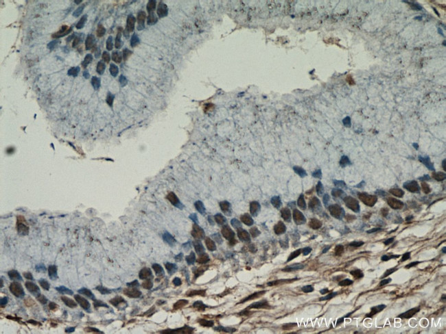 ESR2 Beta-6 Antibody in Immunohistochemistry (Paraffin) (IHC (P))