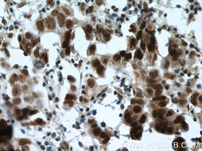 ESR2 Beta-6 Antibody in Immunohistochemistry (Paraffin) (IHC (P))