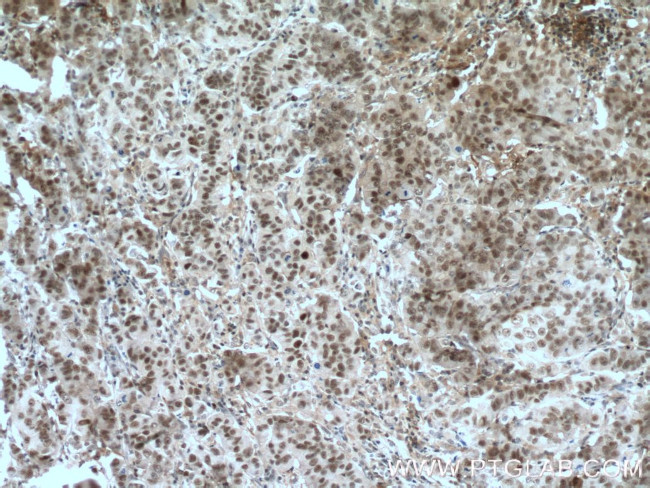 ESR2 Beta-6 Antibody in Immunohistochemistry (Paraffin) (IHC (P))