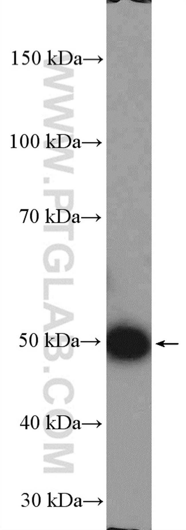 ESR2 Beta-6 Antibody in Western Blot (WB)