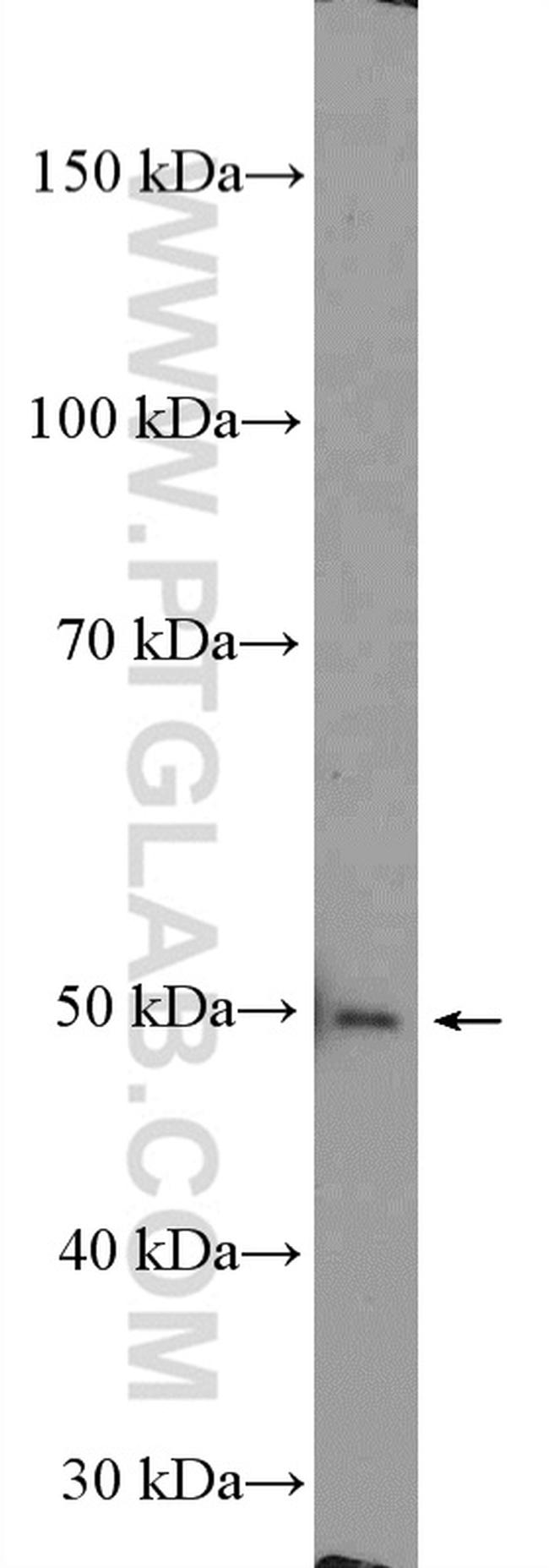 ESR2 Beta-6 Antibody in Western Blot (WB)