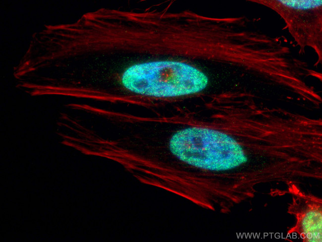 ESR2 Beta-6 Antibody in Immunocytochemistry (ICC/IF)