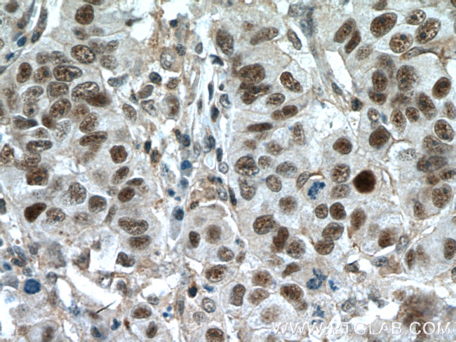 ESR2 Beta-6 Antibody in Immunohistochemistry (Paraffin) (IHC (P))