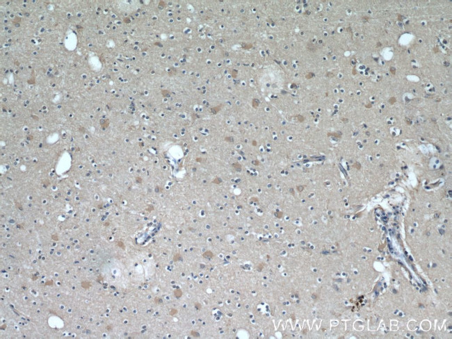 VGLUT1 Antibody in Immunohistochemistry (Paraffin) (IHC (P))