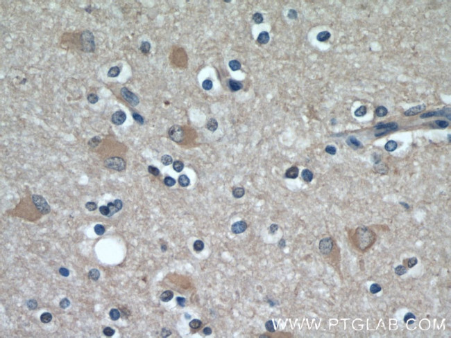 VGLUT1 Antibody in Immunohistochemistry (Paraffin) (IHC (P))