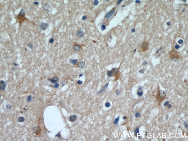 VGLUT1 Antibody in Immunohistochemistry (Paraffin) (IHC (P))