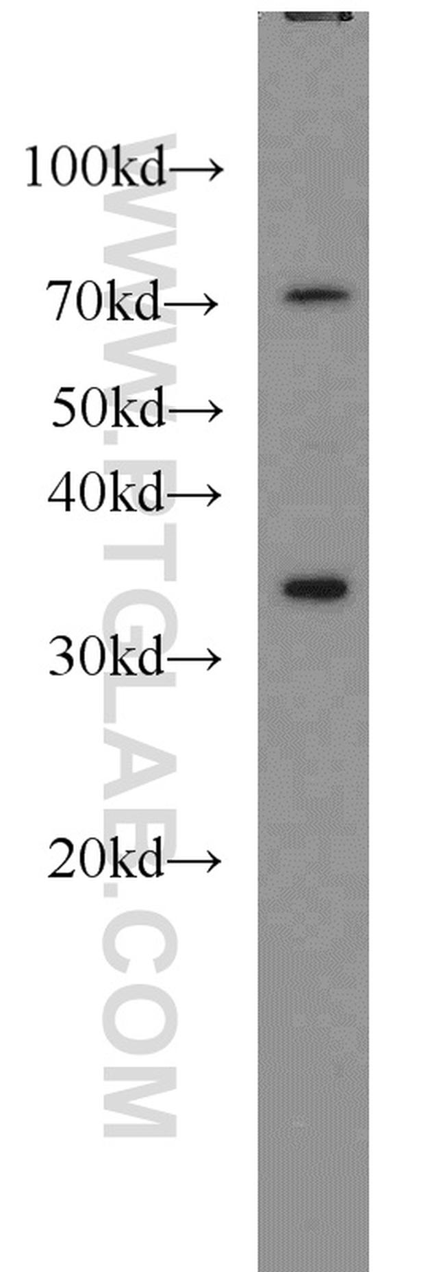 HOXA11 Antibody in Western Blot (WB)