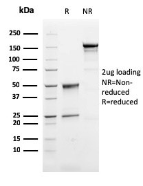 Perforin-1 (Pore Forming Protein) (Apoptosis Marker) Antibody in SDS-PAGE (SDS-PAGE)