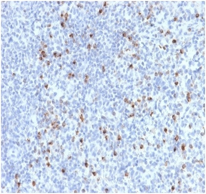 Perforin-1 (Pore Forming Protein) (Apoptosis Marker) Antibody in Immunohistochemistry (Paraffin) (IHC (P))