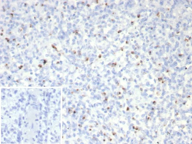 Perforin-1 (Pore Forming Protein) (Apoptosis Marker) Antibody in Immunohistochemistry (Paraffin) (IHC (P))