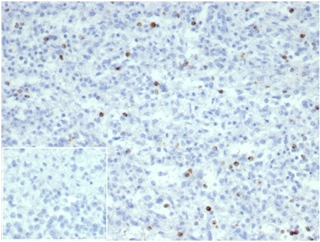 Perforin-1 (Pore Forming Protein) (Apoptosis Marker) Antibody in Immunohistochemistry (Paraffin) (IHC (P))