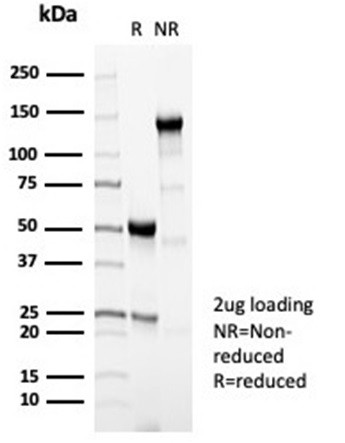 Perforin-1 (Pore Forming Protein) (Apoptosis Marker) Antibody in SDS-PAGE (SDS-PAGE)