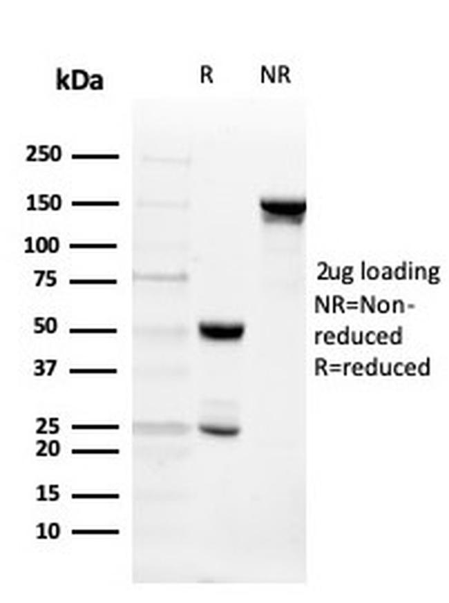 Intelectin 1/Omentin Antibody in SDS-PAGE (SDS-PAGE)