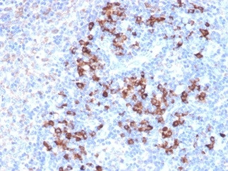 ZFP64 Antibody in Immunohistochemistry (Paraffin) (IHC (P))