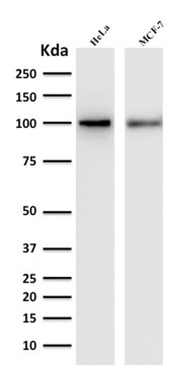 ENAH/MENA (Actin Regulator) Antibody in Western Blot (WB)