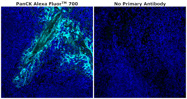 Pan Cytokeratin Antibody in Immunohistochemistry (Paraffin) (IHC (P))