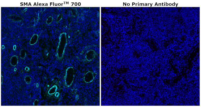 Alpha-Smooth Muscle Actin Antibody in Immunohistochemistry (Paraffin) (IHC (P))