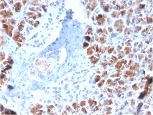 BARX1 Antibody in Immunohistochemistry (Paraffin) (IHC (P))