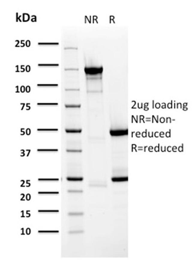 BARX1 Antibody in SDS-PAGE (SDS-PAGE)