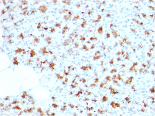 BARX1 Antibody in Immunohistochemistry (Paraffin) (IHC (P))